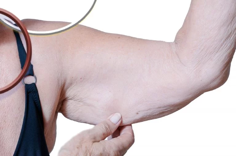 Sarcopenia: O Que É, Sintomas, Causas e Tratamento