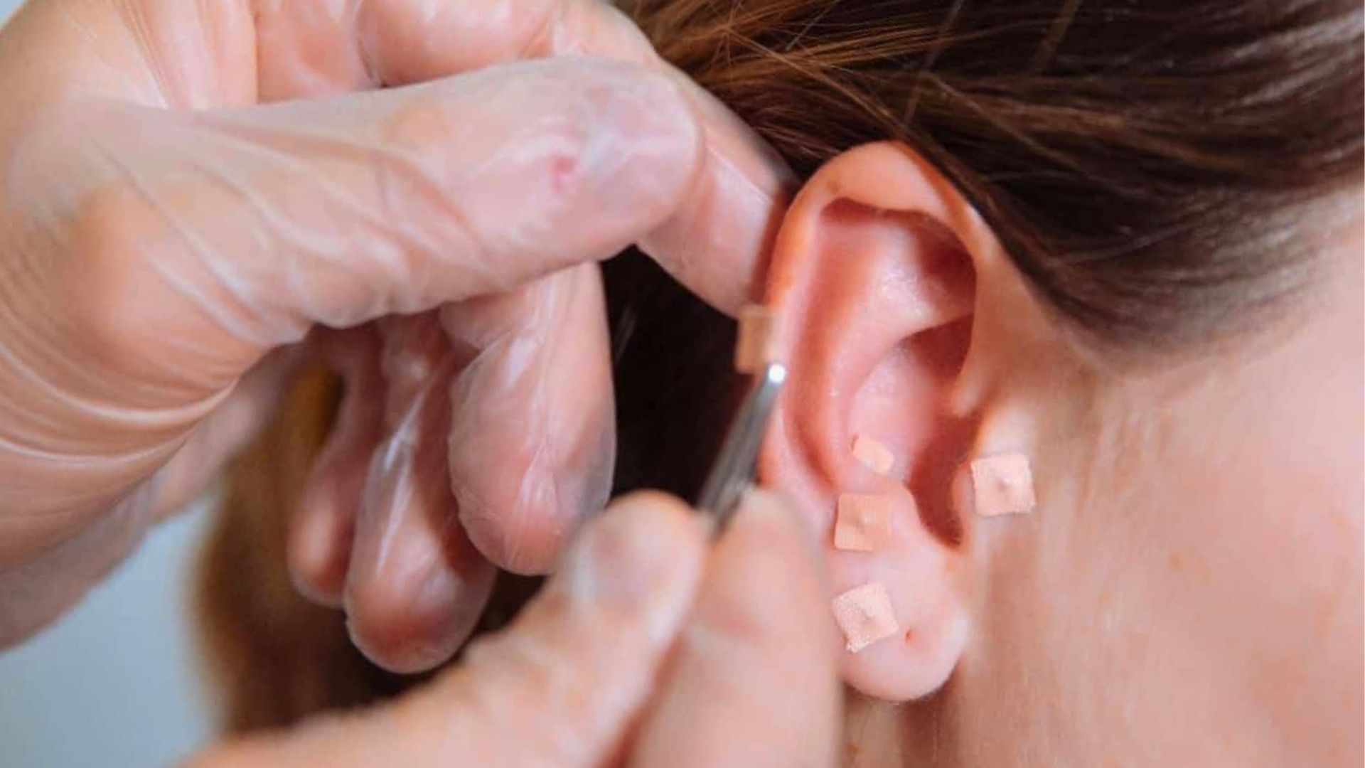 Monte Mor oferece auriculoterapia e mamografia gratuitas